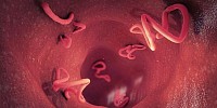 patologias del sistema digestivo