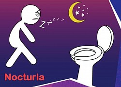 Nocturia: Orinar bastante durante la noche