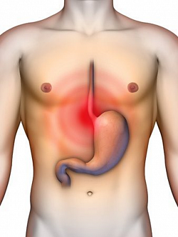Gastritis: Inflamación del estómago